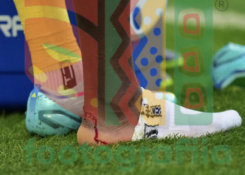 2022 FIFA World Cup - Cameroon vs Serbia